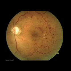 Orthopedics Services